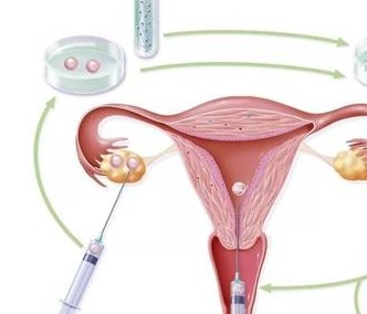胖人能吃盐酸二甲双胍片吗？太胖吃二甲双胍可以减肥吗？